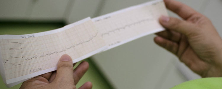 Electrocardiograma en nuestra clínica de cardiología veterinaria en Jerez.