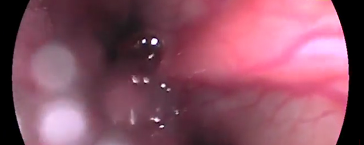 Endoscopia veterinaria en Clínica Veterinaria Ronda Este en Jerez